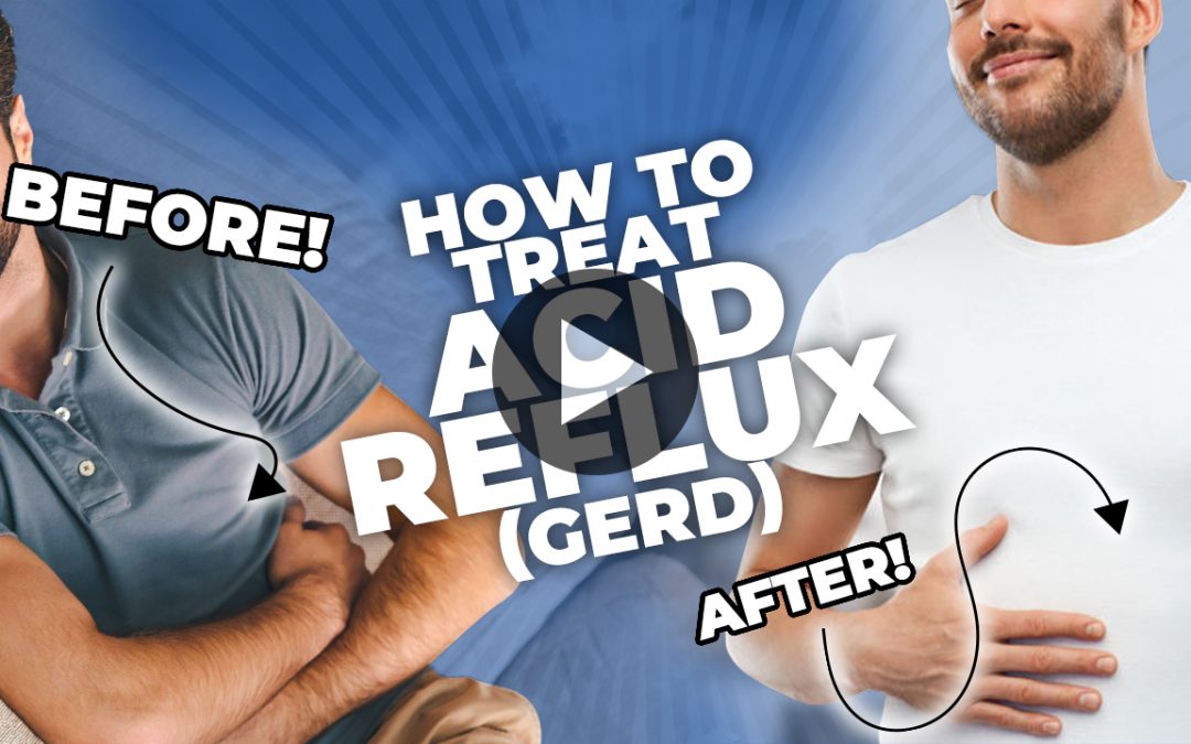 How To Treat Acid Reflux (GERD)